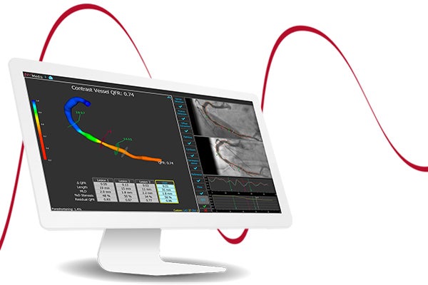 QFR® – QUANTITATIVE FLOW RATIO